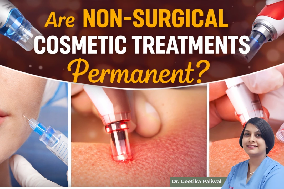 Do non-surgical cosmetic treatments last forever, non-surgical cosmetic treatments, temporary cosmetic results, botox and fillers duration, cosmetologist in Indore, cosmetologist in indore, best cosmetologist indore, skin clinic in indore, aesthetic treatments indore, botox treatment indore, fillers treatment indore, non surgical facelift indore, anti aging treatment indore, skin rejuvenation indore, chemical peel indore, laser skin treatment indore, dermal fillers indore, wrinkle treatment indore, fine lines treatment indore, under eye fillers indore, lip fillers indore, face contouring indore, skin tightening indore, glow treatment indore, pigmentation treatment indore, acne scar treatment indore, skin doctor indore, cosmetic clinic near me indore, beauty treatments indore, skin care expert indore, cosmetic consultation indore, youthful skin treatment indore, non invasive cosmetic procedures indore, facial aesthetics indore, skin enhancement treatment indore