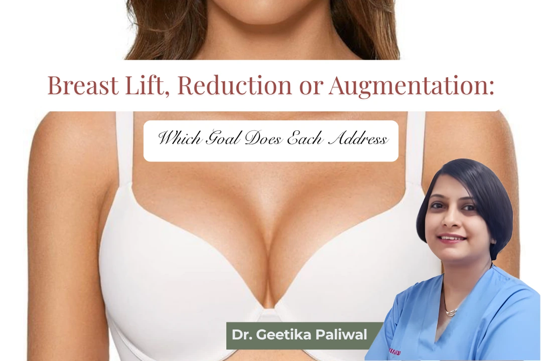 breast lift vs reduction vs augmentation, difference between breast lift and augmentation, breast reduction vs breast lift, breast augmentation in Indore, breast lift surgery in Indore, breast reduction surgery in Indore, surgery for sagging breasts, surgery to reduce breast size, surgery to increase breast size, breast surgery consultation in Indore, breast doctor in Indore, breast surgeon in Indore, best cosmetologist in Indore, breast lifting treatment Indore, breast implant surgery Indore, sagging breast treatment Indore, breast size reduction Indore, cosmetic breast surgery Indore, breast reshaping surgery Indore, mastopexy surgery Indore, breast enhancement surgery Indore, breast reduction specialist Indore, breast augmentation specialist Indore, plastic surgeon for breast surgery Indore, breast cosmetic surgery Indore