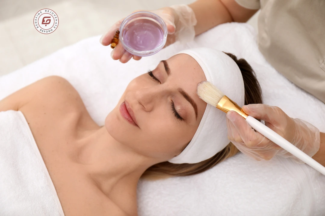 Chemical Peels vs Laser Treatments