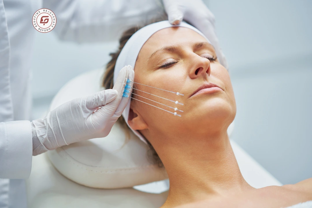 Thread Lift vs Fillers vs Botox