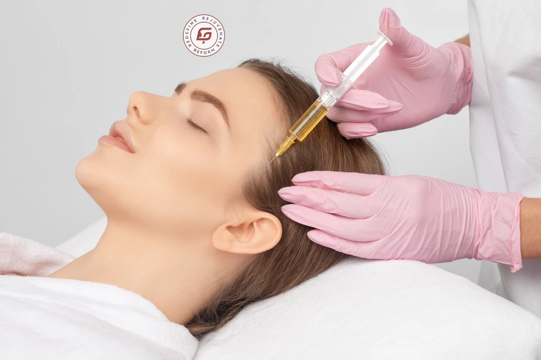 PRP Therapy for Hair Loss