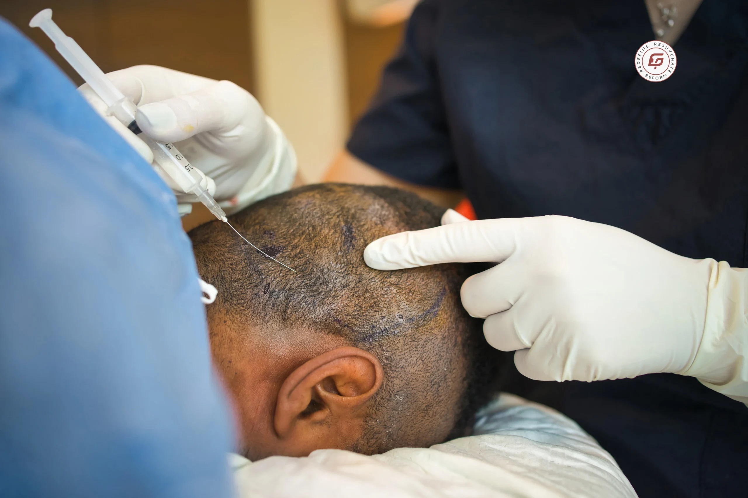 hair transplant, hair transplant cost in Indore, hair transplant in Indore, best hair transplant doctor in Indore, Dr Geetika Paliwal, FUE hair transplant, FUT hair transplant, affordable hair transplant, hair restoration in Indore, cost per graft hair transplant, natural hairline restoration, hair transplant recovery, hair loss treatment in Indore, permanent hair transplant, hair surgery Indore, best cosmetic surgeon in Indore, scalp hair transplant, hair regrowth treatment, hair clinic Indore, safe hair transplant, hair transplant procedure, hair transplant result time, male hair transplant Indore, female hair transplant Indore, advanced hair transplant, painless hair transplant