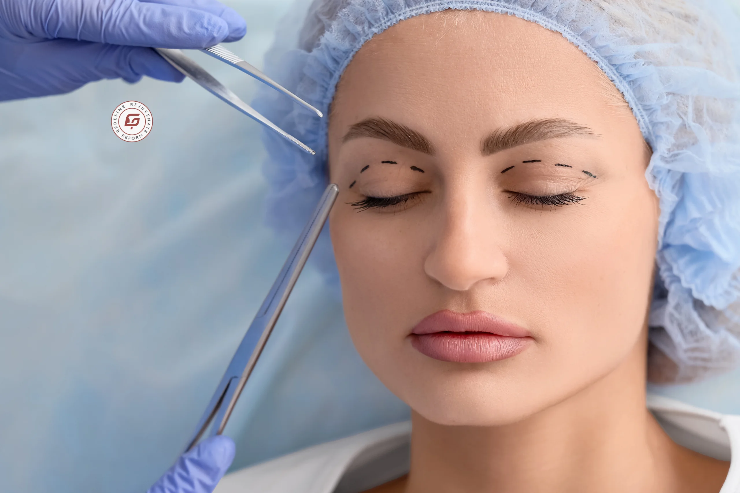 eyelid surgery, blepharoplasty, eyelid surgery benefits, cosmetic eyelid surgery, upper eyelid surgery, lower eyelid surgery, droopy eyelid treatment, eye bag removal, eyelid lift surgery, eyelid surgery recovery, eyelid surgery results, eyelid surgery safety, cosmetic surgeon for eyelid surgery, facial rejuvenation surgery, eye rejuvenation treatment, blepharoplasty procedure, eyelid correction surgery, eyelid surgery before after, eyelid surgery consultation, aesthetic eyelid surgery, eye appearance improvement, cosmetic eye treatment, eyelid surgery myths, eyelid surgery facts, Dr Geetika Paliwal