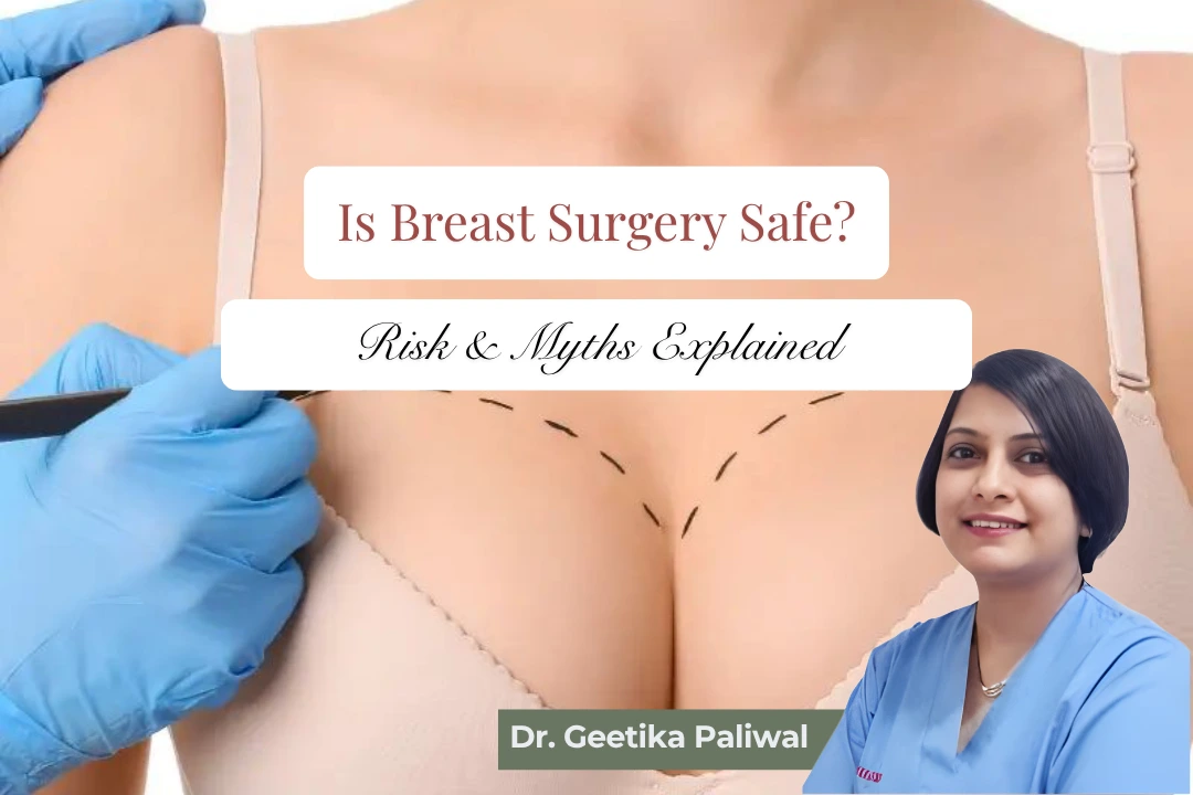 Is Breast Surgery Safe, Dr. Geetika Paliwal, Cosmetologist in Indore, Breast Surgery Risks, Breast Surgery Myths, best cosmetologist in indore, breast surgery in indore, breast augmentation in indore, breast reduction surgery indore, breast lift surgery indore, cosmetic surgeon indore, breast implant specialist indore, safe breast surgery indore, plastic surgeon indore, aesthetic clinic indore, cosmetic procedures indore, breast enhancement surgery indore, breast surgery consultation indore, breast implant risks indore, breast surgery recovery indore, natural looking breast surgery indore, cosmetic breast procedures indore, advanced cosmetic surgery indore, female cosmetic doctor indore, breast reshaping surgery indore, cosmetic treatment indore, breast surgery expert indore, cosmetic clinic indore, breast implant consultation indore, trusted cosmetologist indore, body contouring indore, cosmetic care indore, cosmetic surgery specialist indore, breast correction surgery indore, aesthetic treatments indore
