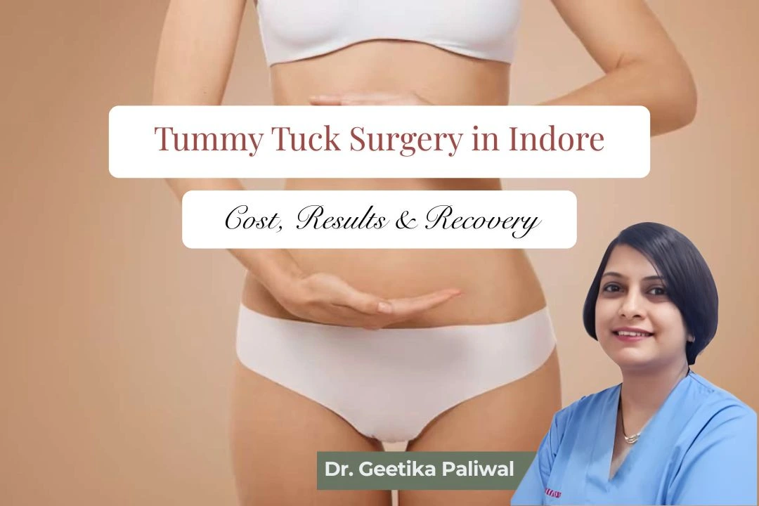 Tummy Tuck Surgery in Indore, Tummy Tuck Cost in Indore, Abdominoplasty Surgery, Loose Skin Removal Surgery, Cosmetologist in Indore, tummy tuck doctor in indore, tummy tuck treatment indore, best tummy tuck surgery in indore, abdominoplasty in indore, tummy shaping surgery indore, loose abdominal skin treatment indore, cosmetic surgery clinic indore, body contouring treatment indore, fat removal surgery indore, post pregnancy tummy surgery indore, skin tightening surgery indore, tummy fat surgery indore, cosmetic procedures indore, best cosmetologist in indore, body reshaping surgery indore, tummy tuck recovery indore, tummy tuck consultation indore, abdominal contouring indore, post weight loss surgery indore, skin removal surgery indore, aesthetic clinic indore, body sculpting treatment indore, cosmetic skin clinic indore, female cosmetologist indore, tummy tuck specialist indore, advanced cosmetic surgery indore, tummy correction surgery indore, cosmetic abdomen surgery indore, loose tummy skin treatment indore, cosmetic tummy treatment indore