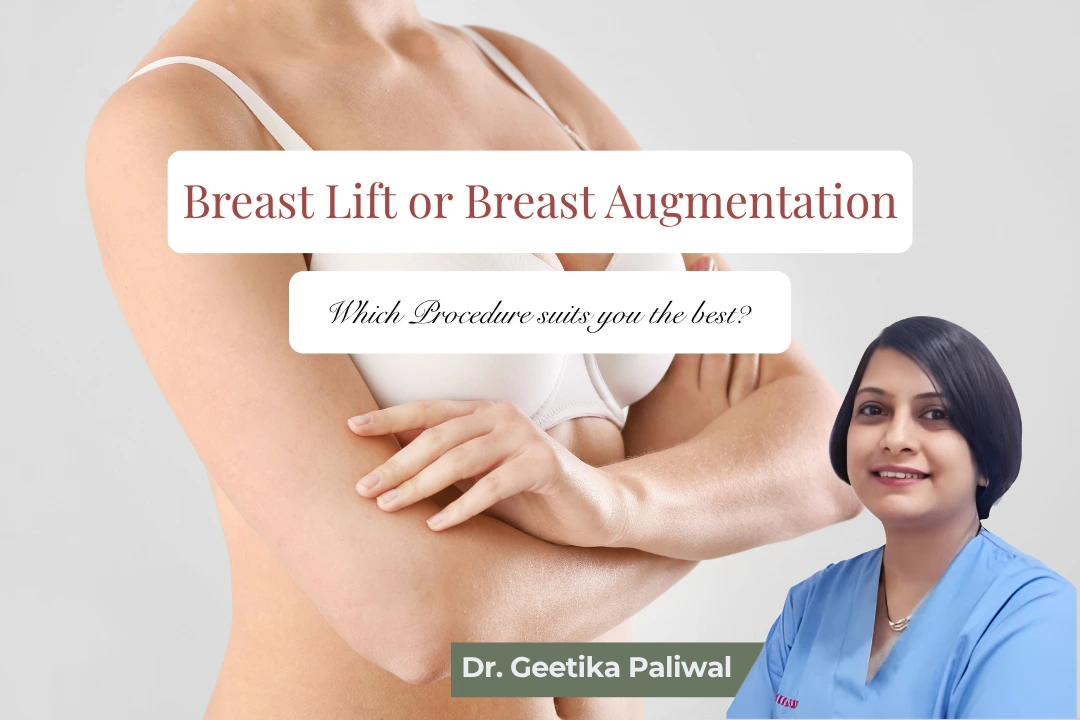 breast lift in Indore, breast augmentation in Indore, breast implant surgery in Indore, breast reshaping in Indore, breast enhancement in Indore, cosmetic breast surgery Indore, breast lift surgeon Indore, breast augmentation surgeon Indore, female cosmetic surgeon in Indore, cosmetologist in Indore, plastic surgeon in Indore, breast surgery clinic Indore, breast implant clinic Indore, best breast lift treatment Indore, breast tightening surgery Indore, sagging breast treatment Indore, breast volume correction Indore, breast cosmetic treatment Indore, breast surgery consultation Indore, breast augmentation consultation Indore, breast lift consultation Indore, cosmetic surgery clinic Indore, body contouring clinic Indore, breast correction surgery Indore, breast implant specialist Indore, natural breast enhancement Indore, breast lift after pregnancy Indore, breast augmentation after pregnancy Indore, breast reshaping after weight loss Indore, Sukriti Clinic Indore