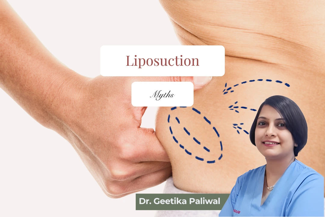 best liposuction doctor in Indore, liposuction surgeon in Indore, cosmetic surgeon in Indore, cosmetologist in Indore, body contouring in Indore, fat removal surgery in Indore, tummy liposuction in Indore, thigh liposuction in Indore, arm liposuction in Indore, chin liposuction in Indore, waist fat removal in Indore, abdomen fat reduction in Indore, stubborn fat treatment in Indore, liposuction consultation in Indore, liposuction clinic in Indore, liposuction cost in Indore, safe liposuction in Indore, advanced liposuction in Indore, liposuction recovery in Indore, liposuction results in Indore, female cosmetic surgeon in Indore, body shaping treatment in Indore, body sculpting in Indore, cosmetic surgery clinic in Indore, fat reduction procedure in Indore, post-pregnancy body contouring Indore, liposuction for women in Indore, liposuction for men in Indore, plastic surgery in Indore, aesthetic body treatment in Indore