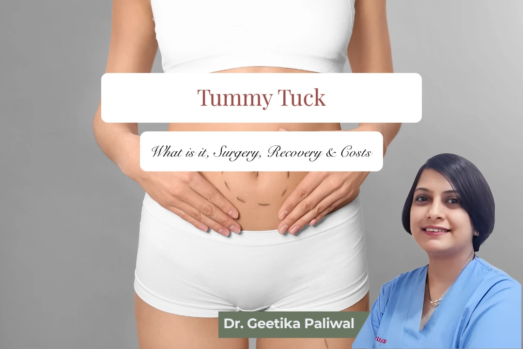 tummy tuck in Indore, tummy tuck surgery in Indore, tummy tuck cost in Indore, best tummy tuck surgeon in Indore, cosmetologist in Indore, cosmetic surgery in Indore, abdominoplasty in Indore, abdominoplasty surgery Indore, tummy tightening surgery Indore, loose belly skin treatment Indore, post pregnancy tummy tuck Indore, mommy makeover Indore, body contouring in Indore, belly fat removal surgery Indore, abdominal skin tightening Indore, mini tummy tuck Indore, full tummy tuck Indore, tummy tuck specialist Indore, cosmetic clinic in Indore, plastic surgery clinic Indore, best cosmetologist in Indore, skin tightening surgery Indore, body shaping surgery Indore, liposuction and tummy tuck Indore, abdomen reshaping Indore, tummy tuck consultation Indore, safe tummy tuck surgery Indore, female cosmetologist Indore, Dr. Geetika Paliwal Indore, Sukriti Clinic Indore