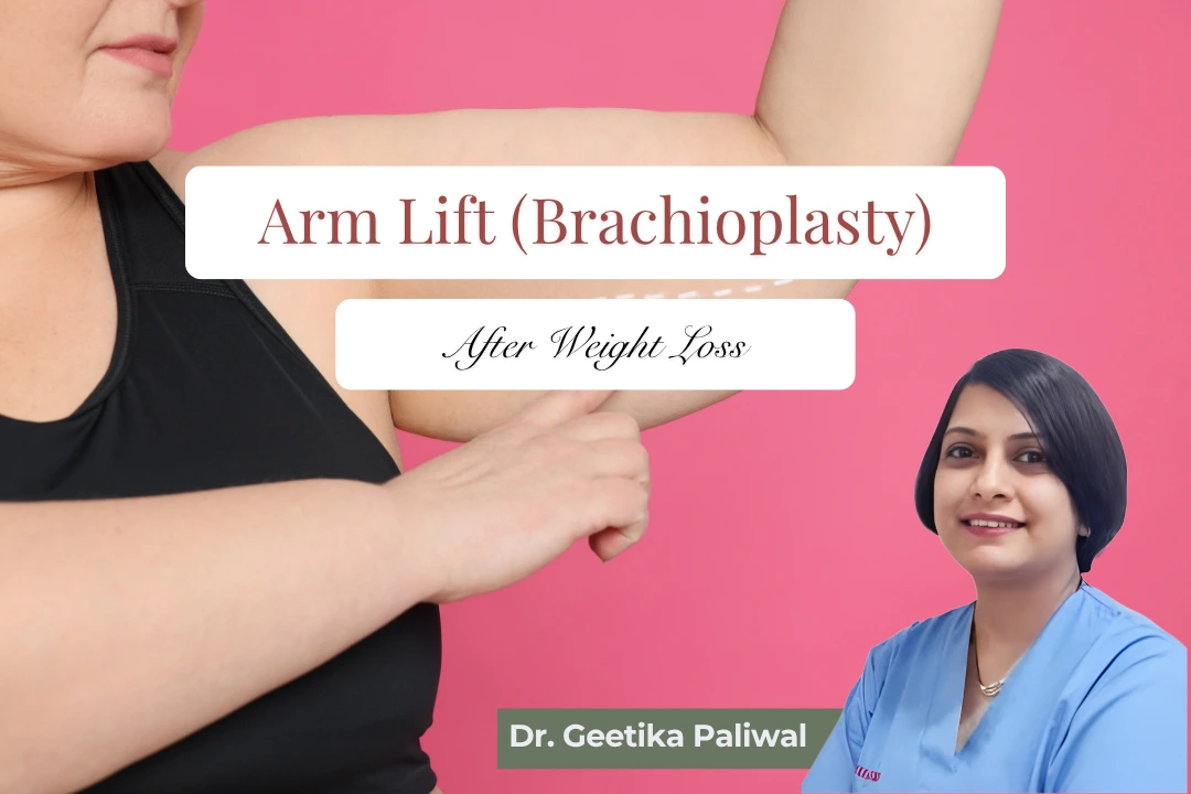 Arm lift surgery in Indore, Brachioplasty in Indore, Arm lift surgeon in Indore, Best arm lift surgeon in Indore, Upper arm lift in Indore, Loose arm skin treatment in Indore, Post-weight-loss surgery in Indore, Body contouring surgeon in Indore, Body contouring after weight loss in Indore, Cosmetic surgeon in Indore, Plastic surgeon in Indore, Female cosmetic surgeon in Indore, Excess skin removal in Indore, Upper arm skin tightening in Indore, Arm contouring surgery in Indore, Arm reshaping treatment in Indore, Brachioplasty specialist in Indore, Arm lift consultation in Indore, Brachioplasty cost in Indore, Arm lift recovery in Indore, Arm lift before and after in Indore, Post-bariatric body contouring in Indore, Skin removal surgery in Indore, Arm liposuction in Indore, Sagging arm treatment in Indore, Bat wing correction in Indore, Body shaping surgery in Indore, Cosmetic surgery clinic in Indore, Arm lift specialist in Madhya Pradesh, Brachioplasty doctor near me in Indore
