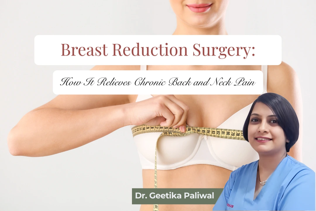 Breast Reduction Surgery, Breast reduction for back pain, Breast reduction for neck pain, Reduction mammaplasty, Benefits of breast reduction surgery, Breast reduction surgery in Indore, Best breast reduction surgeon in Indore, Breast reduction doctor in Indore, Breast reduction cost in Indore, Breast reduction clinic in Indore, Cosmetic surgeon for breast reduction in Indore, Female cosmetic surgeon in Indore, Breast reduction consultation in Indore, Reduction mammaplasty in Indore, Macromastia treatment in Indore, Large breast treatment in Indore, Breast reduction for back pain in Indore, Breast reduction for neck pain in Indore, Breast reduction for shoulder pain in Indore, Heavy breast treatment in Indore, Breast surgery specialist in Indore, Breast reshaping surgery in Indore, Breast lift and reduction in Indore, Breast reduction hospital in Indore, Safe breast reduction surgery in Indore, Breast reduction recovery in Indore, Breast reduction results in Indore, Breast reduction surgeon near me, Best cosmetologist in Indore, Cosmetologist for breast surgery in Indore, Women’s cosmetic surgery in Indore, Affordable breast reduction surgery in Indore, Breast reduction after pregnancy in Indore, Breast reduction for posture problems in Indore, Breast reduction treatment in Madhya Pradesh