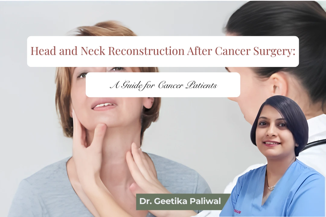 Head and neck reconstruction surgery Indore, head and neck reconstructive surgeon Indore, cancer reconstruction surgery Indore, post cancer reconstruction surgery Indore, oral cancer reconstruction Indore, jaw reconstruction surgery Indore, tongue reconstruction surgery Indore, facial reconstruction after cancer Indore, neck reconstruction surgery Indore, microvascular reconstruction surgery Indore, free flap surgery Indore, free flap reconstruction Indore, fibula free flap surgery Indore, facial reconstructive surgeon Indore, cancer reconstruction specialist Indore, reconstructive plastic surgeon Indore, head and neck cancer reconstruction Indore, plastic surgeon for cancer reconstruction Indore, oral cavity reconstruction Indore, mandible reconstruction surgery Indore, jaw reconstruction after oral cancer Indore, facial reconstruction surgery Indore, cancer surgery reconstruction Indore, microsurgery for cancer reconstruction Indore, post oral cancer reconstructive surgery Indore, head and neck plastic surgeon Indore, reconstructive surgery after cancer Indore, Dr Geetika Paliwal reconstructive surgeon Indore, Dr Geetika Paliwal plastic surgeon Indore, head and neck reconstruction specialist Indore