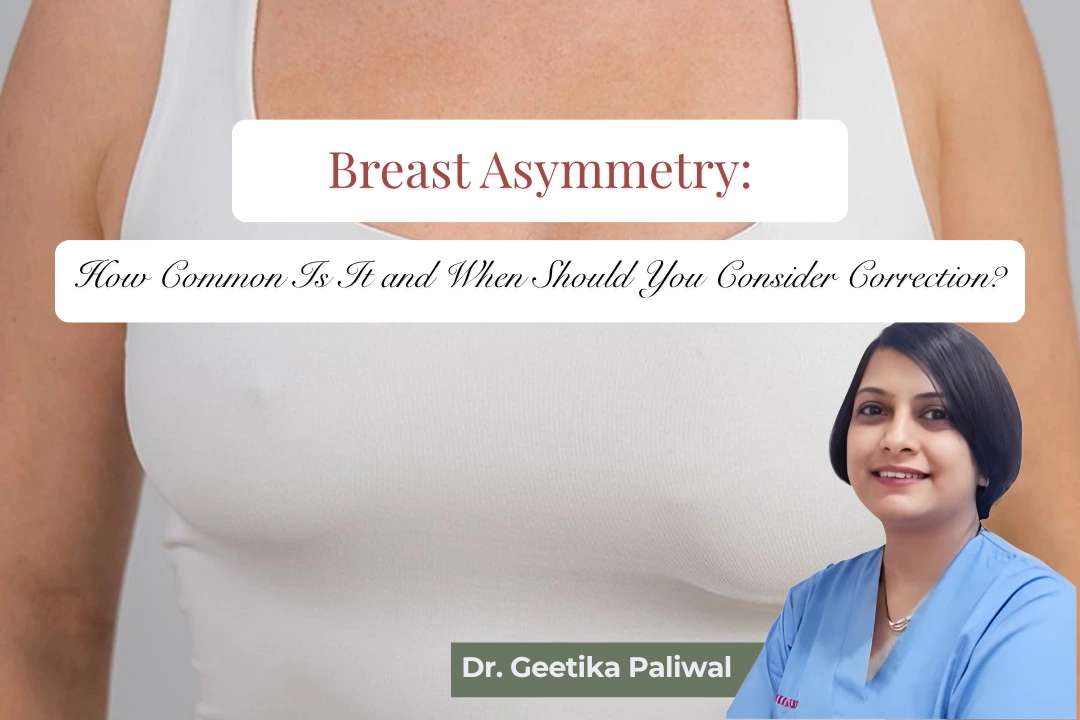 breast asymmetry, breast asymmetry correction, breast asymmetry treatment, breast asymmetry surgery, breast asymmetry correction in Indore, uneven breasts, uneven breast treatment, one breast bigger than the other, one breast smaller than the other, breast size difference, breast shape asymmetry, breast imbalance correction, breast correction surgery, asymmetric breast treatment, breast augmentation for asymmetry, breast reduction for asymmetry, breast lift for asymmetry, mastopexy for uneven breasts, fat grafting for breast asymmetry, breast implant for asymmetry, breast reconstruction in Indore, cosmetic breast surgery Indore, breast plastic surgery Indore, breast surgeon in Indore, plastic surgeon in Indore, reconstructive surgeon in Indore, Dr Geetika Paliwal, Dr Geetika Paliwal Indore, uneven breast correction Indore, breast symmetry surgery