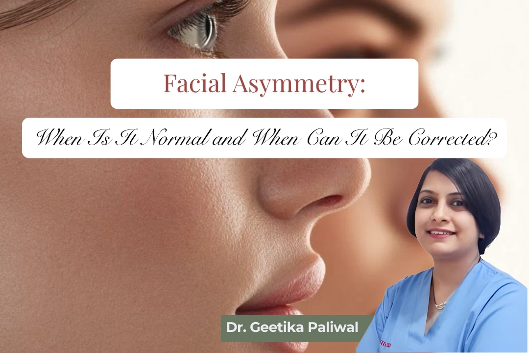 facial asymmetry, facial asymmetry treatment, facial asymmetry treatment in Indore, facial asymmetry correction, facial asymmetry surgery, uneven face treatment, uneven face correction, face asymmetry causes, facial asymmetry symptoms, facial reconstruction surgery, facial reconstruction in Indore, facial contour correction, facial contouring surgery, face symmetry treatment, facial imbalance treatment, jaw asymmetry treatment, cheek asymmetry correction, chin asymmetry correction, facial trauma reconstruction, facial reconstruction after accident, facial asymmetry after trauma, facial asymmetry after surgery, facial fat grafting, fat grafting for facial asymmetry, reconstructive surgeon in Indore, plastic surgeon in Indore, Dr Geetika Paliwal, Dr Geetika Paliwal Indore, facial plastic surgery Indore, facial deformity correction Indore