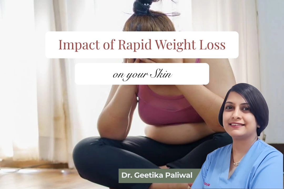impact of rapid weight loss on skin, loose skin after weight loss, loose skin treatment in Indore, post weight loss body contouring Indore, body contouring surgery Indore, weight loss skin tightening Indore, excess skin removal Indore, tummy tuck after weight loss Indore, abdominoplasty in Indore, arm lift Indore, thigh lift Indore, breast lift after weight loss Indore, lower body lift Indore, post bariatric surgery Indore, post bariatric body contouring Indore, sagging skin treatment Indore, skin tightening treatment Indore, loose abdominal skin Indore, plastic surgeon for loose skin Indore, body lift surgery Indore, facial volume loss after weight loss, face rejuvenation after weight loss Indore, neck lift Indore, facelift Indore, cosmetic surgery Indore, female plastic surgeon Indore, plastic surgeon Indore, post weight loss surgery Indore, Dr Geetika Paliwal Indore, Dr Geetika Paliwal plastic surgeon