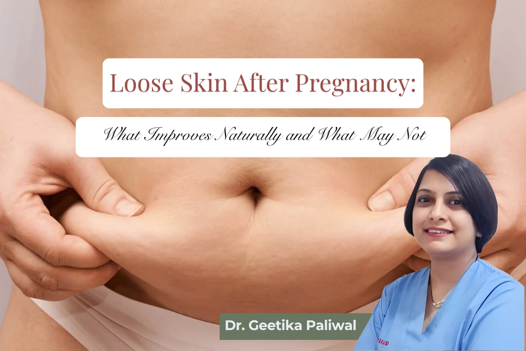 Loose skin after pregnancy, postpartum loose skin, loose belly skin after pregnancy, tummy tuck after pregnancy, postpartum body changes, abdominal skin tightening, diastasis recti after pregnancy, Mommy Makeover in Indore, tummy tuck surgeon in Indore, plastic surgeon in Indore, cosmetic surgeon in Indore, Dr. Geetika Paliwal.